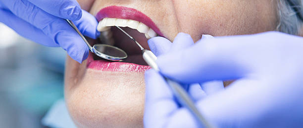 Best Emergency Wisdom Teeth Removal in Logan, UT